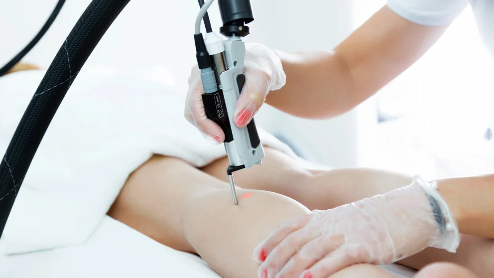 Manipolo di laser ad alessandrite utilizzato per epilazione estetica professionale