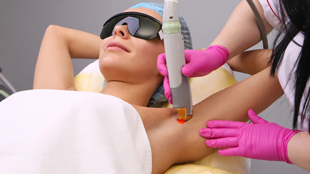 Manipolo di laser Nd:YAG professionale utilizzato per epilazione estetica su fototipi scuri