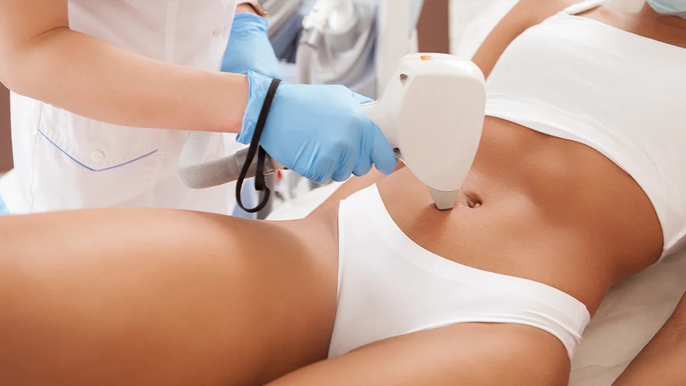 Epilazione laser