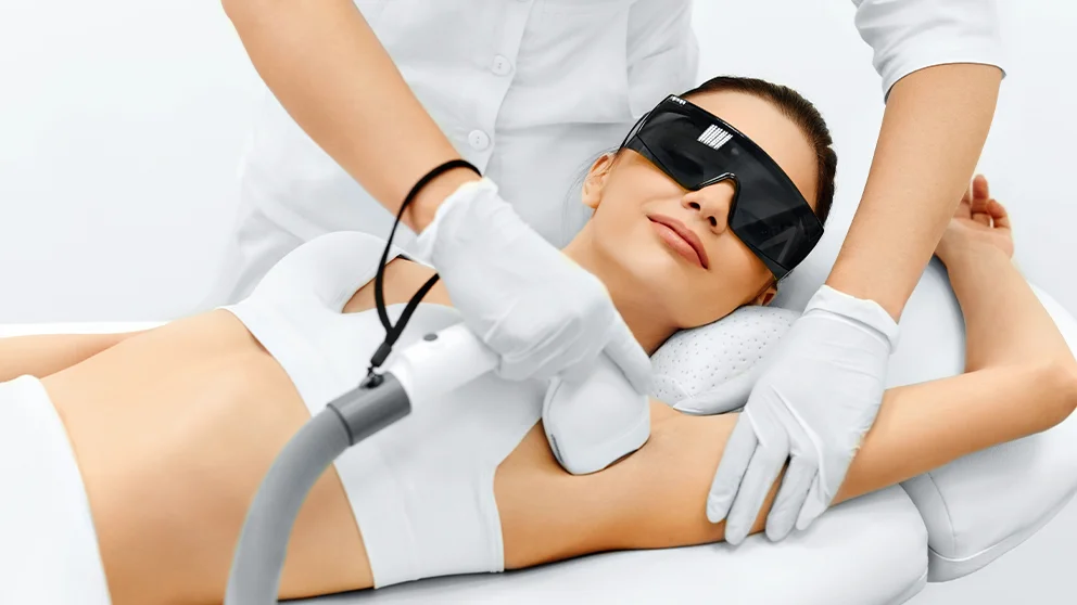 Procedura di epilazione laser in studio